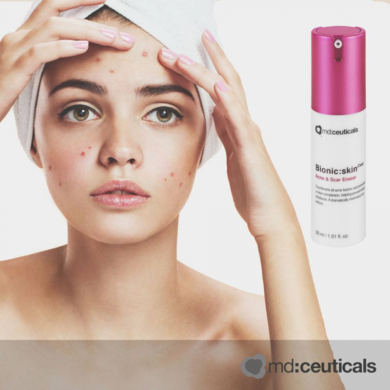  Kem đặc trị mụn và ngăn ngừa sẹo đột phá MD: Ceuticals bionic skinclear scar eraser