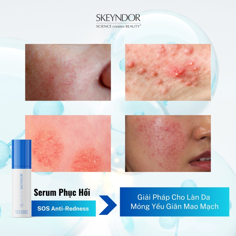 SKEYNDOR AQUATHERM DEEP MOISTURISING CREAM FII KEM DƯỠNG PHỤC HỒI & CẤP ẨM CHUYÊN SÂU CHO DA KHÔ NHẠY CẢM