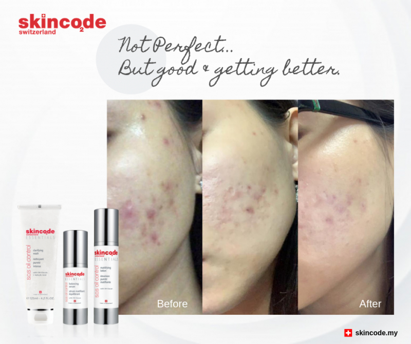 Nhũ tương điều trị mụn và phục hồi da Skincode essential oil control mattifying lotion