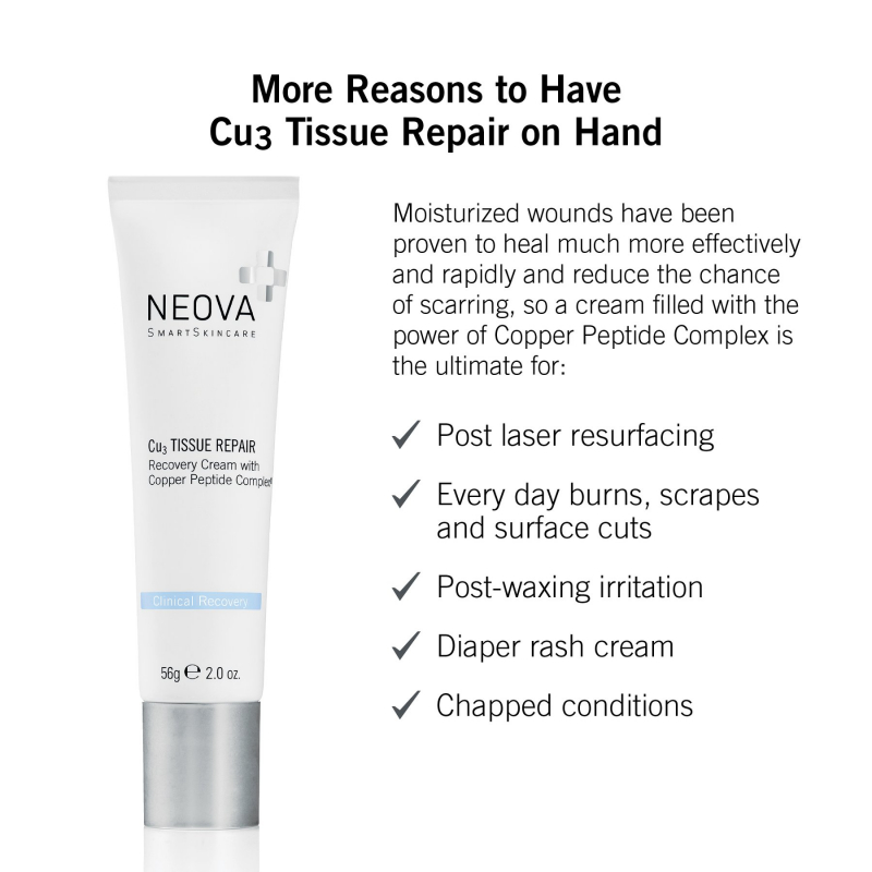 Kem phục hồi da sau laser, bỏng hay lăn kim Neova Cu3 Tissue Repair with Copper Peptide Complex