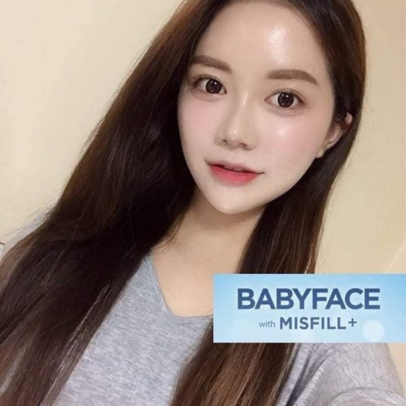 Căng bóng, trẻ hóa da BabyFace